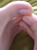 Between the toes. Fanny's feet(6)